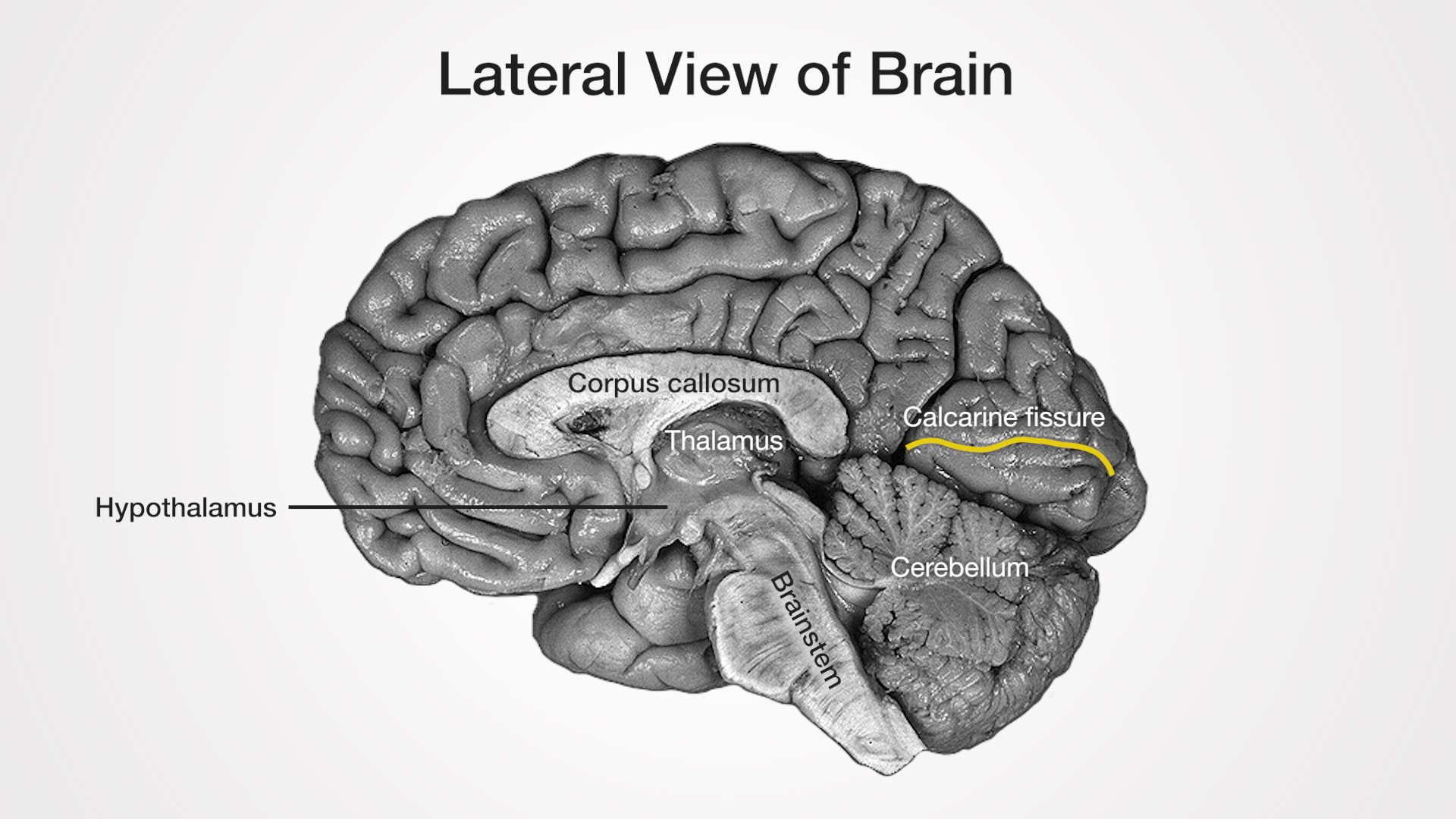 Labels (top to bottom): Corpus callosum, Calcarine fissure, Thalamus, Hypothalamus, Cerebellum, Brainstem