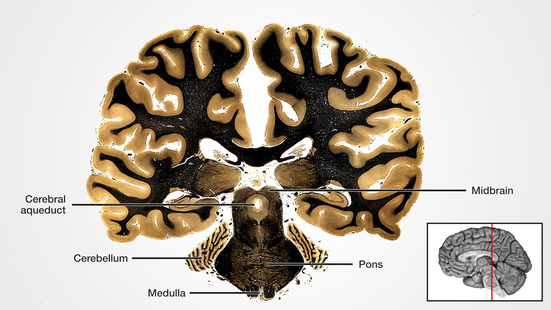 Labels (left to right): Cerebral aqueduct, cerebellum, medulla, pons, midbrain