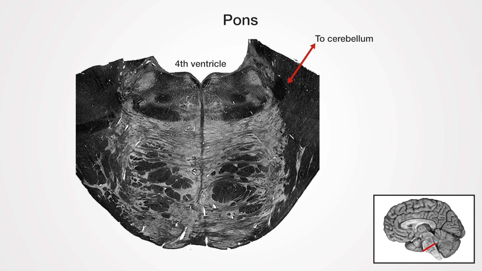 Labels (left to right): 4th ventricle, to cerebellum (bidirectional arrow)