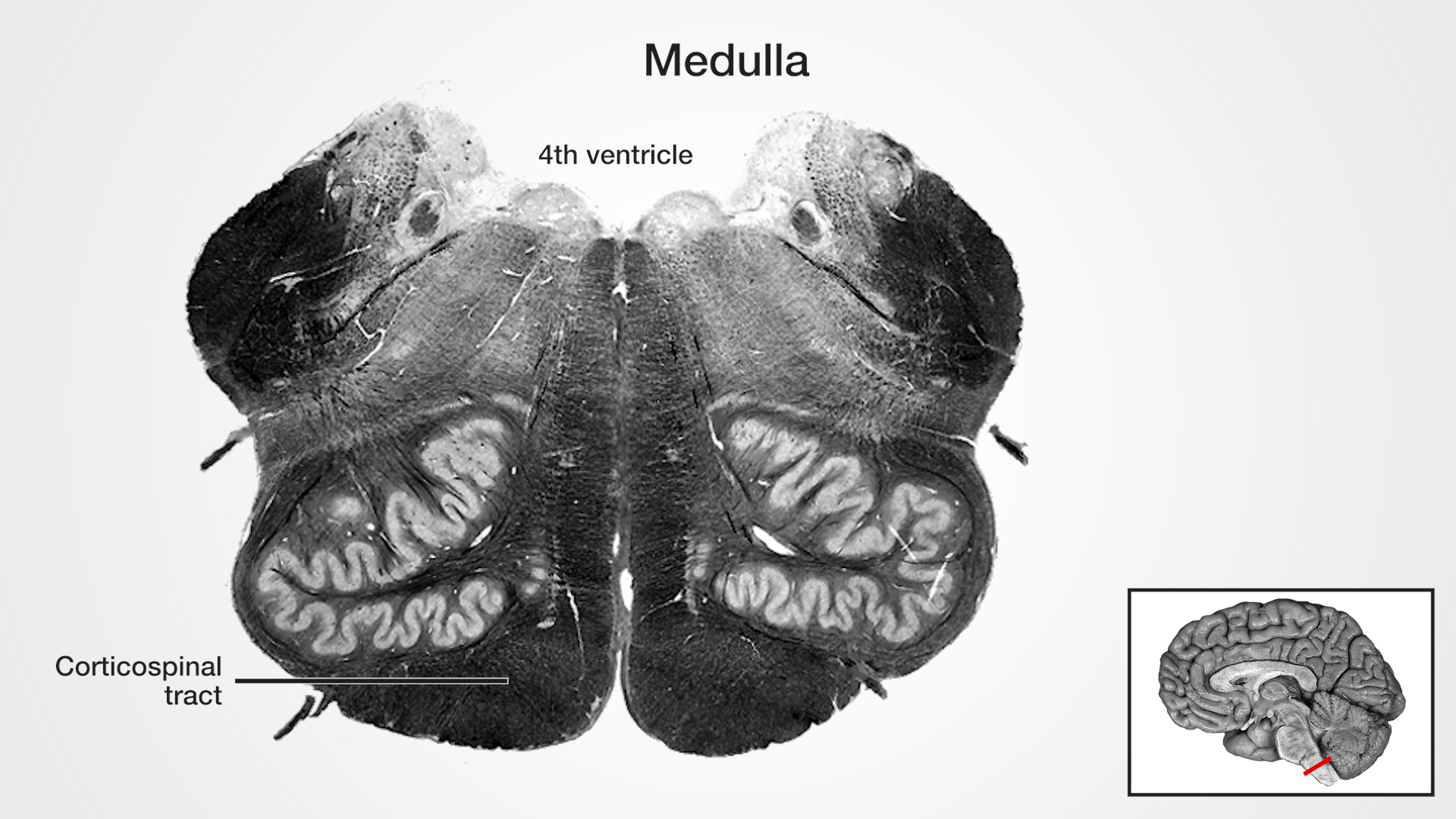 Labels (top to bottom): 4th ventricle, corticospinal tract