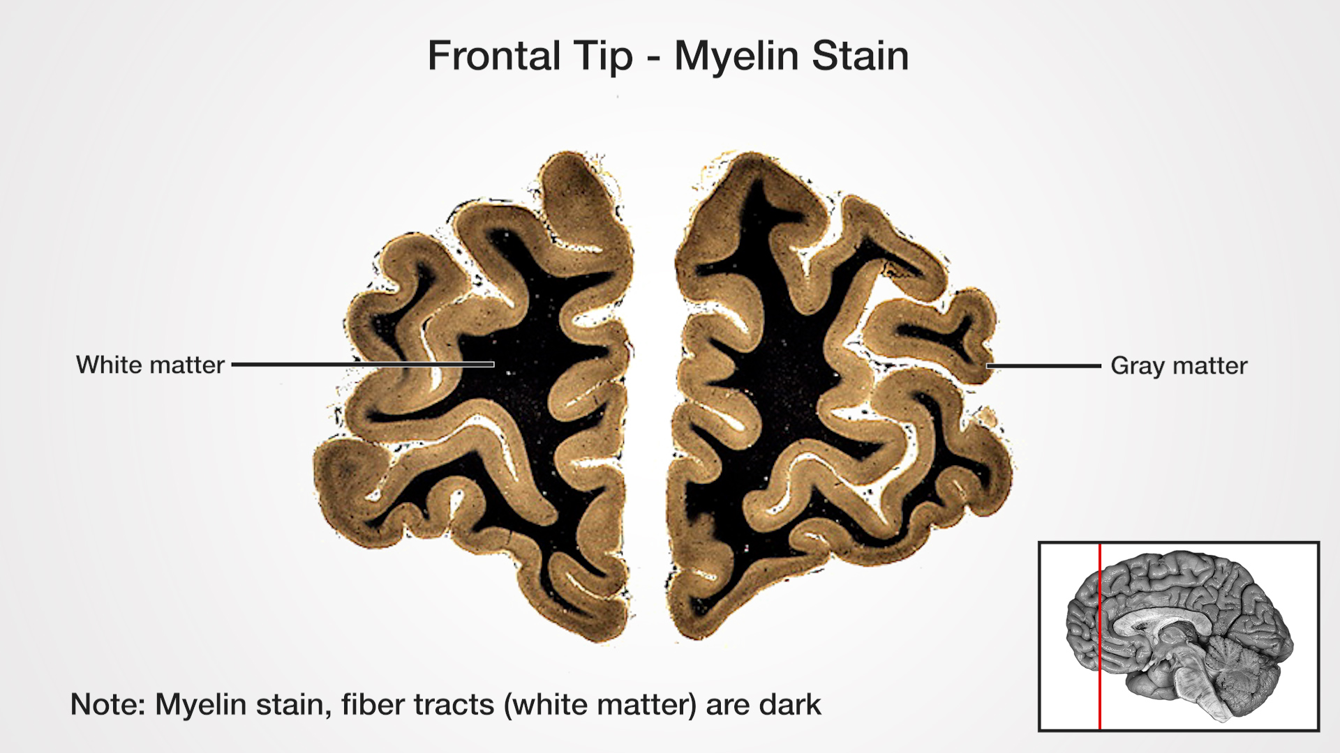 Note: Myelin stain, fiber tracts (white matter) are dark Labels (left to right): White matter, gray matter