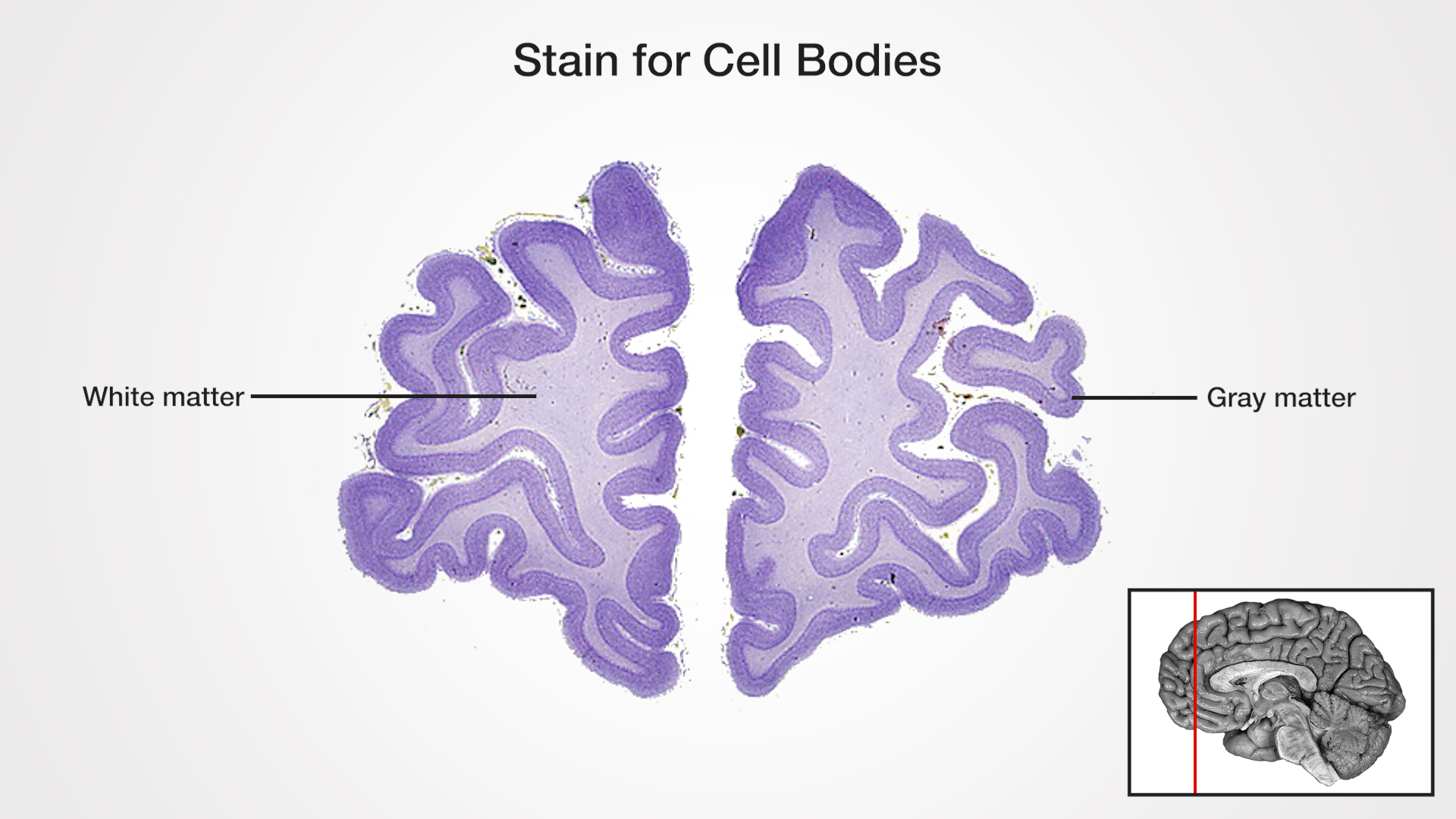 Labels (left to right): White matter, gray matter