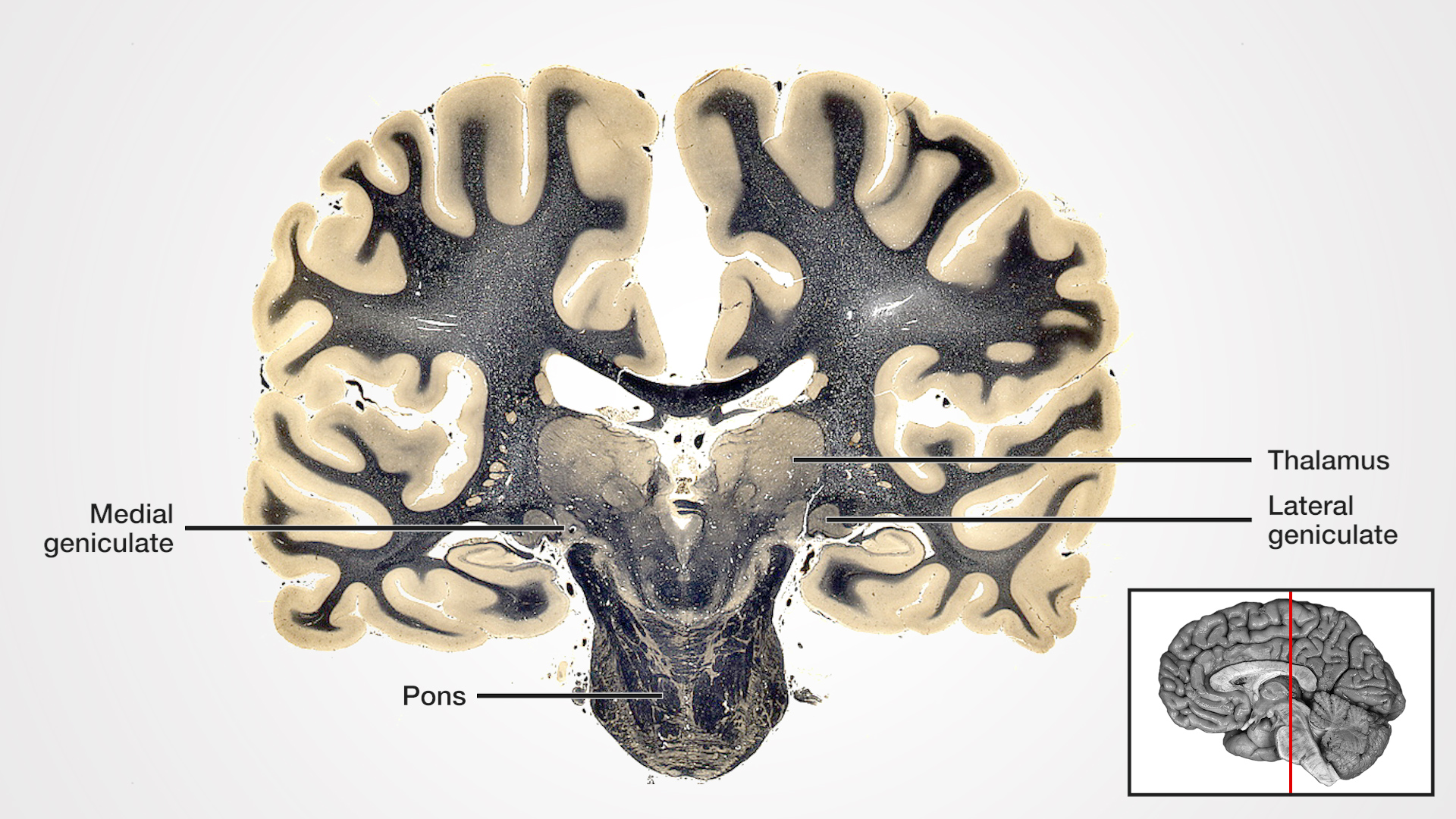 Labels (left to right): Medial geniculate, pons, thalamus, lateral geniculate